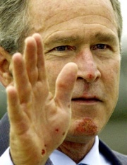 Bush after falling off his bike.